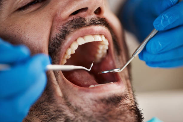 Best Full Mouth Reconstruction  in Coldwater, MI